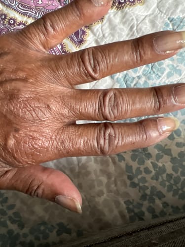 Customer photo review of Rocket Nail Fuel Repair Original Duo