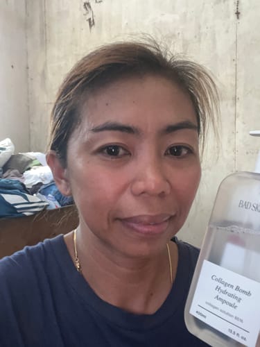 Customer photo review of Bad Skin™ Korean Collagen Bomb Hydrating Ampoule