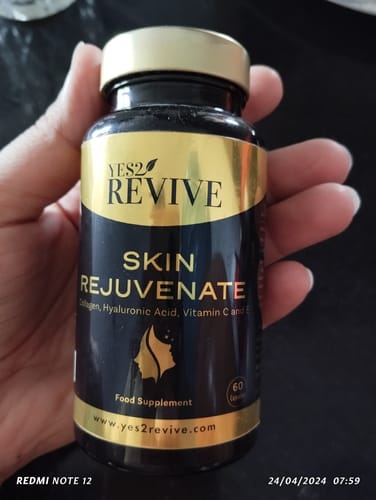 Customer photo review of Skin Rejuvenate - Best Skincare and Skin Glow Supplements
