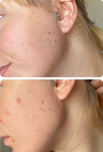 Customer photo review of 40-Day Inside & Out™ Gut Program