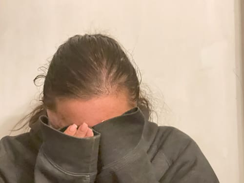 Customer photo review of Revive & Retain Scalp Spray