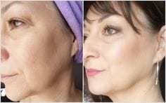 Customer photo review of Appareil EMS - Rajeunissement Facial et du Cou