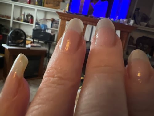 Customer photo review of Rocket Nail Fuel Nail Repair - Clear