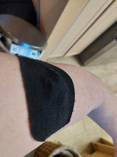 Customer photo review of Skin Grip Original - Medtronic Guardian/Enlite Adhesive Patches - 20 Pack