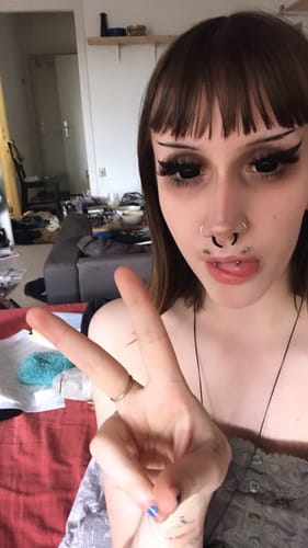 Customer photo review of Linn's Sullen Doll Eye 17mm Mini Sclera Contact Lenses(12 months of use)