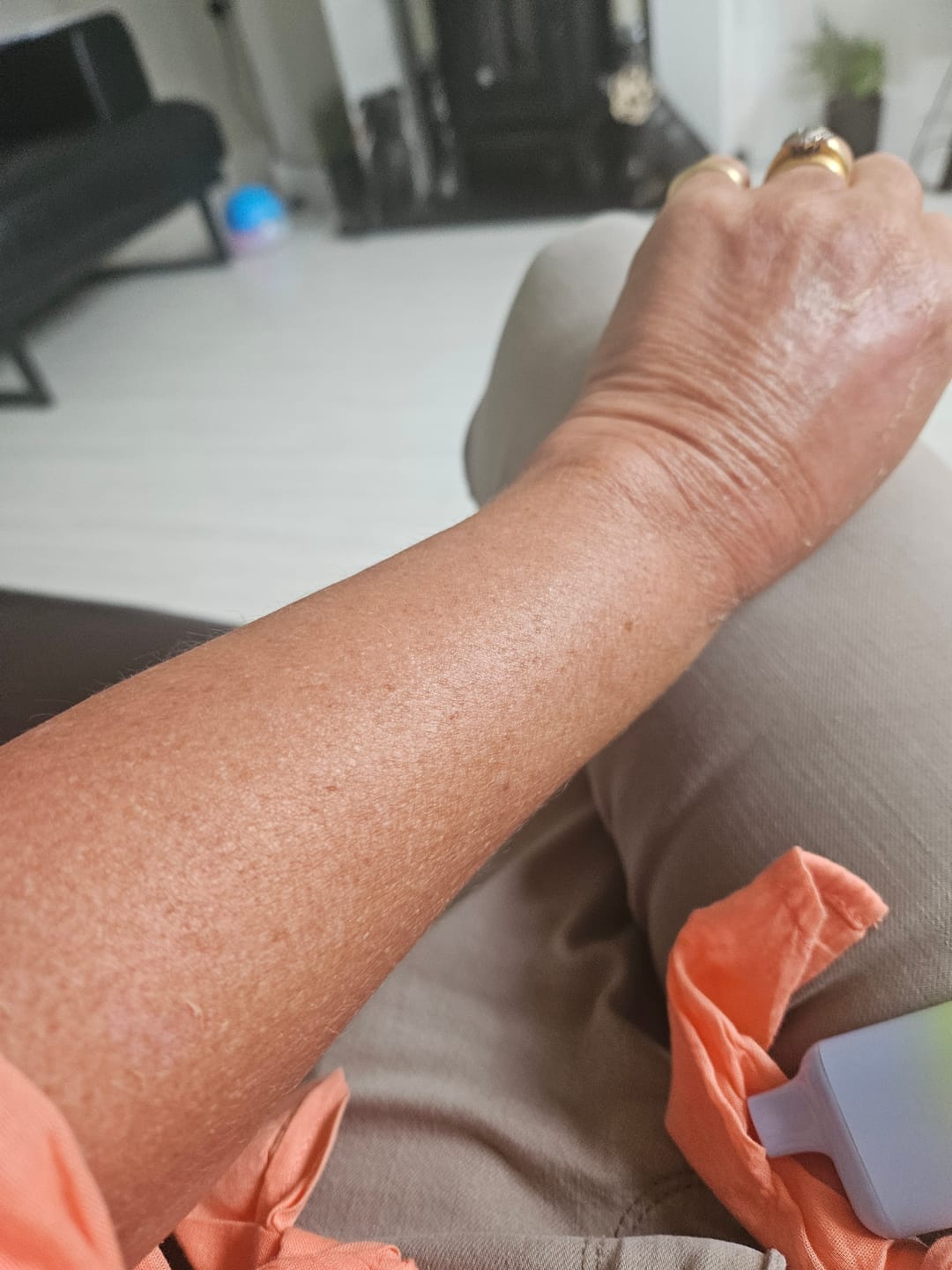 Customer photo review of Melanoboost Peptide Sun Tanning Lotion