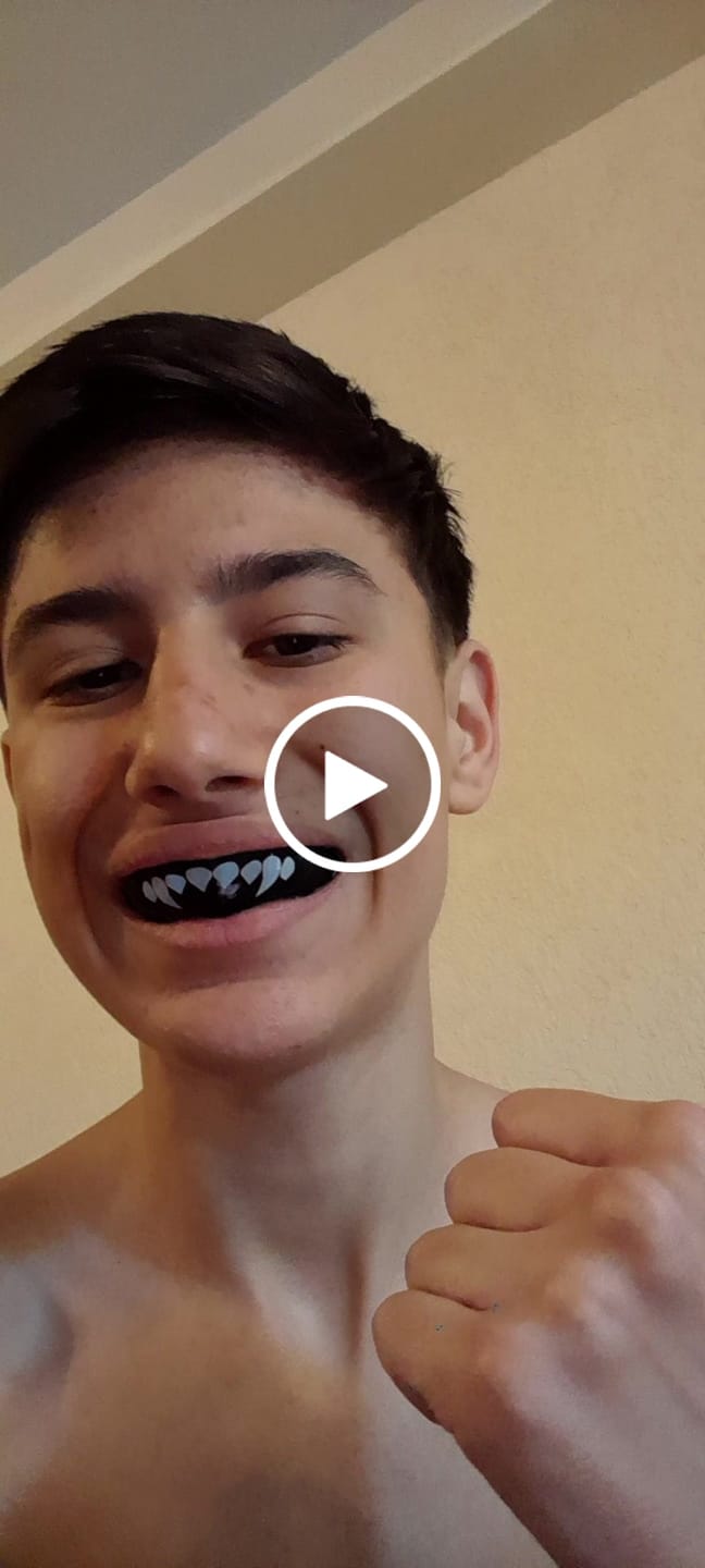 Customer video review of Proteza Dentara Knockout GEL Vampire