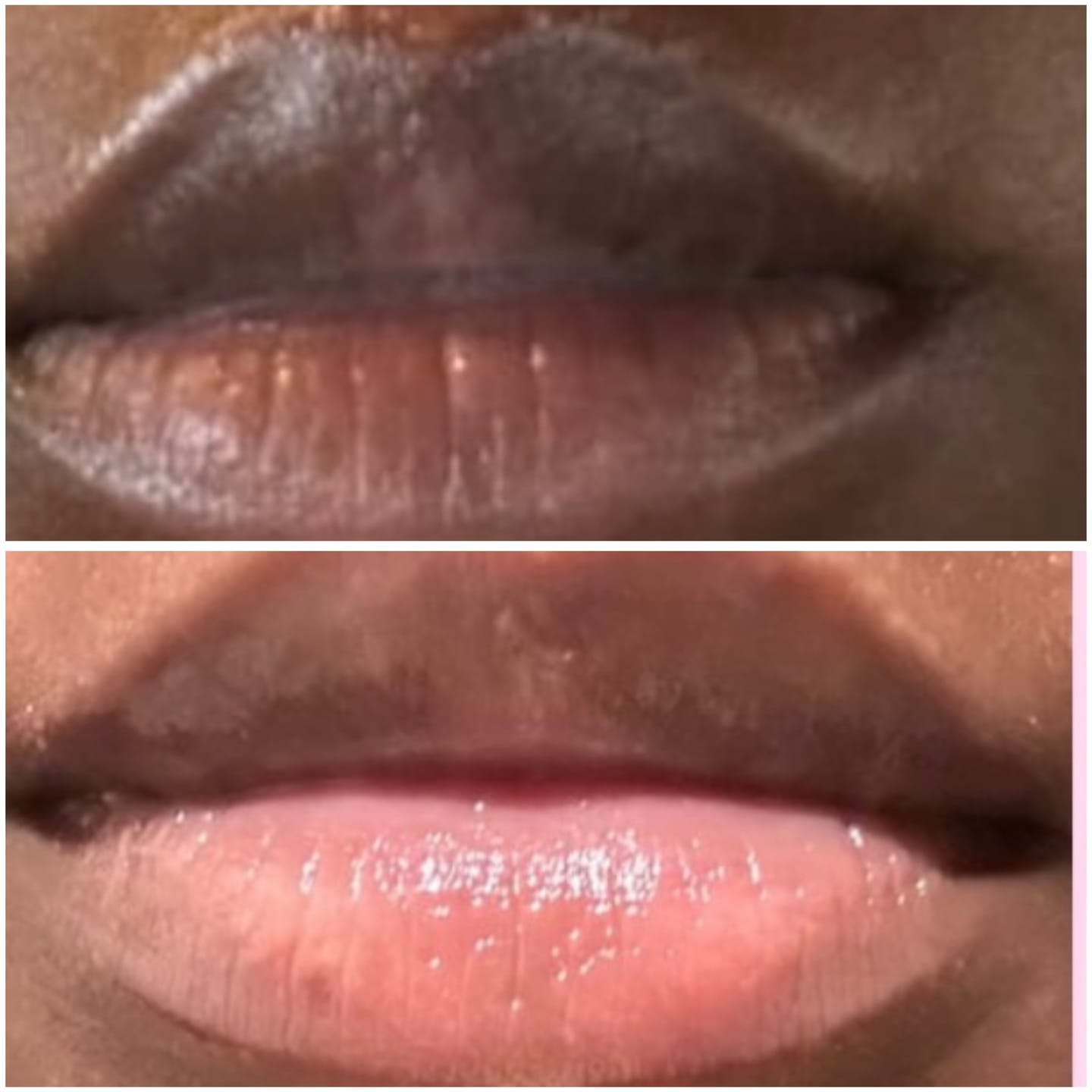 Customer photo review of Pink Lip Kit