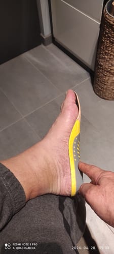 Customer photo review of Ortopéd Pro Talpbetét Plantar Fasciitis Enyhítésére