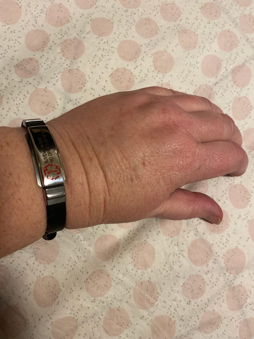 Customer photo review of Personalised Black Silicone Medical Alert ID Bracelet