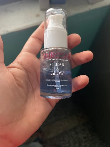 Customer photo review of Clear & Glow - 5% Benzoyl Peroxide Acne Gel