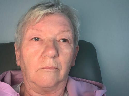 Customer photo review of Vitamin D Face Cream