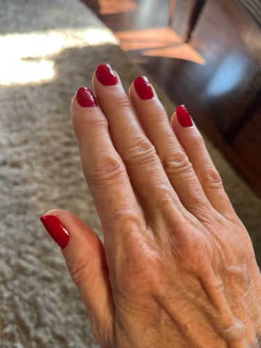 Customer photo review of Rocket Nail Fuel Repair Original Duo