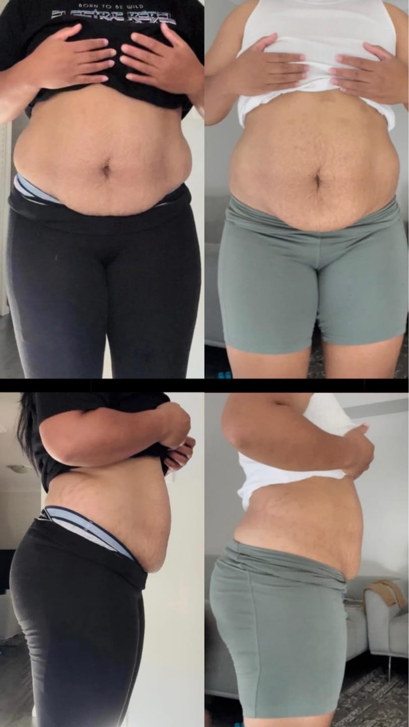 Customer photo review of 14 Day Detox Tea + FREE SHIPPING $110+