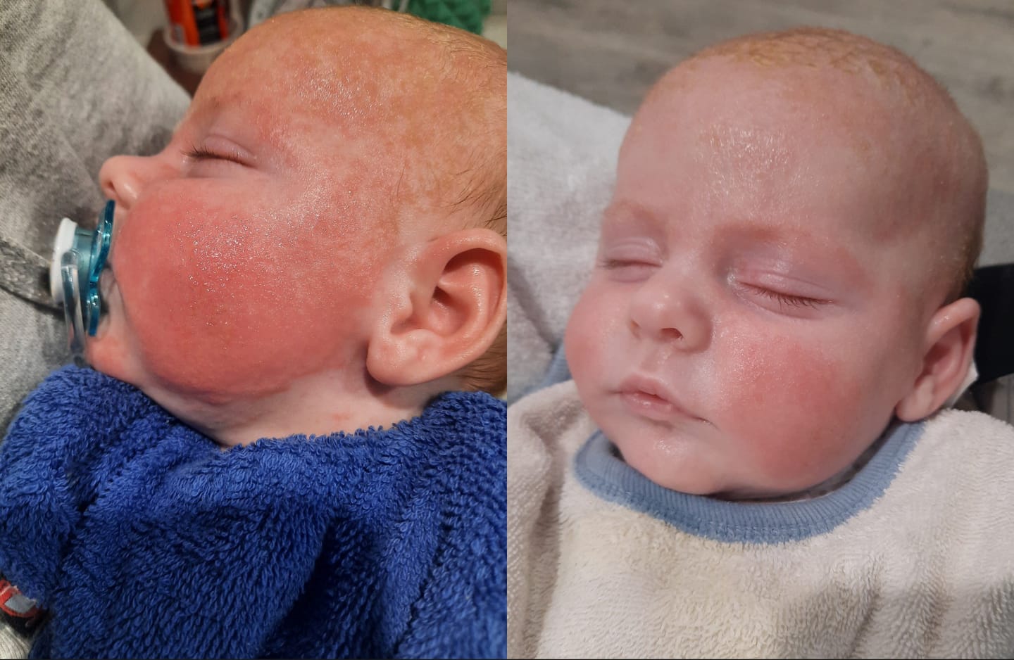 Customer photo review of Chamomile Sleep Balm