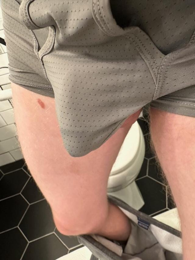Customer photo review of Men's Cooling Separate Pouch Boxer Briefs Dual Pouch Underwear
