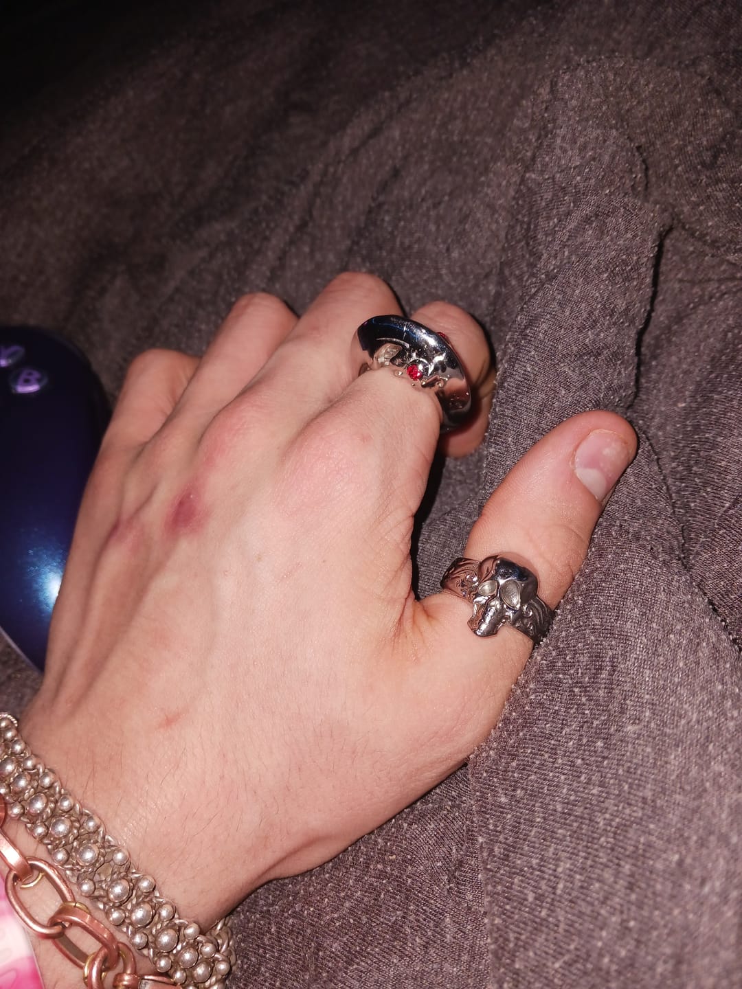 Customer photo review of HALLUCINOGENIC RING
