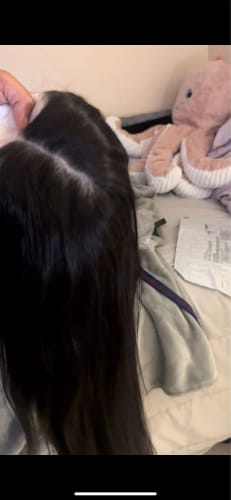 Customer photo review of Skinlike Real HD Lace 13x4 Full Frontal Lace Wig Straight Pre Plucked Clean Hairline