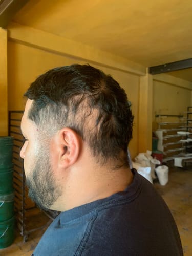 Customer photo review of HAIRtamin Fórmula Avanzada