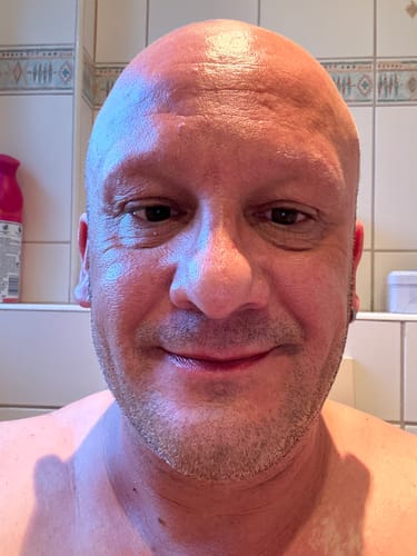 Customer photo review of Hochwirksame Pflegeroutine gegen Alterung