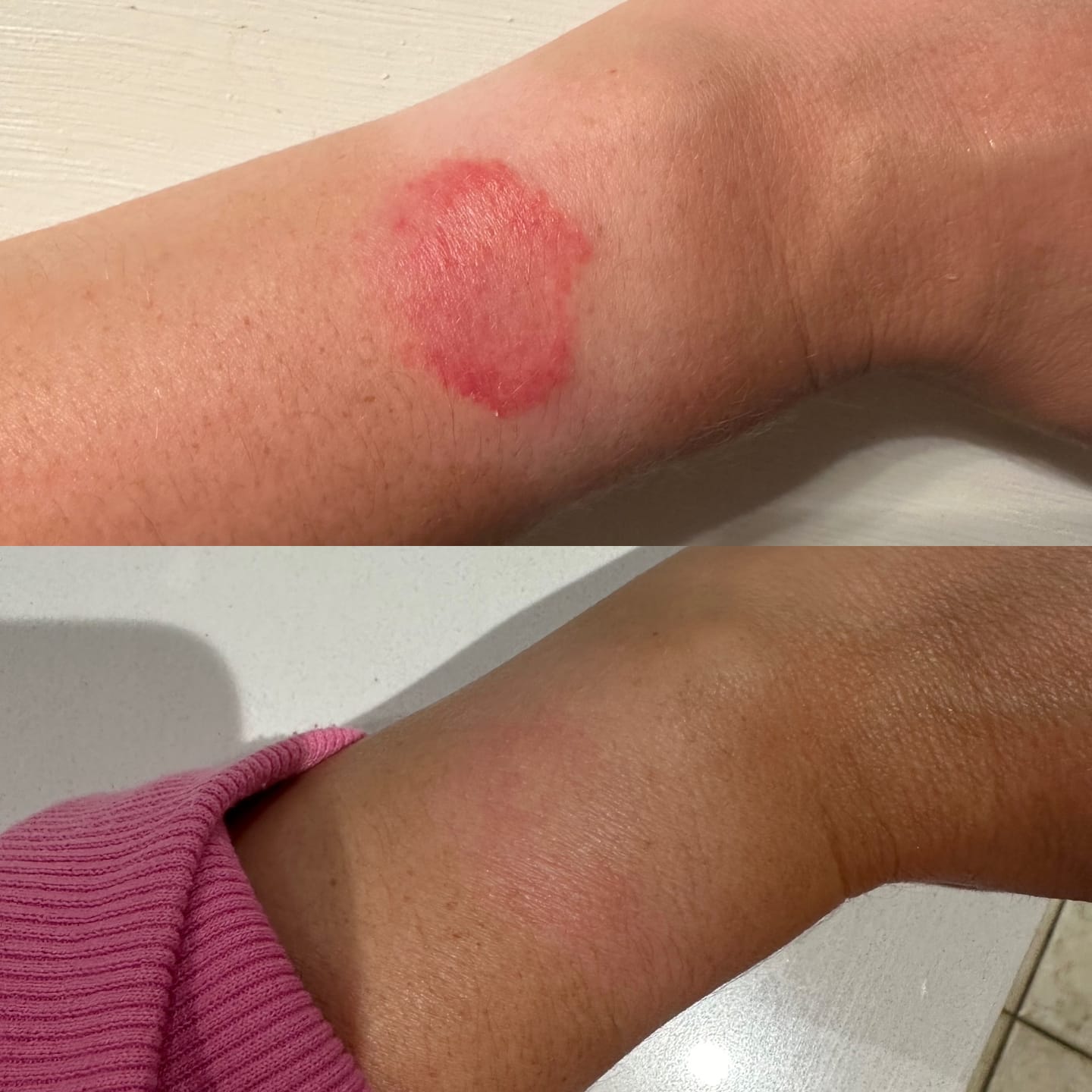 Customer photo review of Healing Salve | CBD
