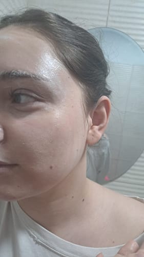 Customer photo review of HEARTLEAF QUERCETINOL PORE DEEP CLEANSING FOAM