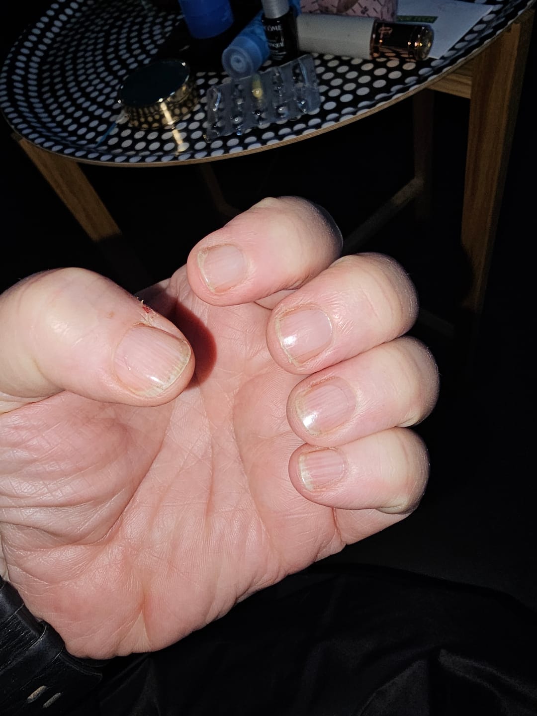 Customer photo review of Nourishing Cuticle Oil Pen & Gellae Nail Remover
