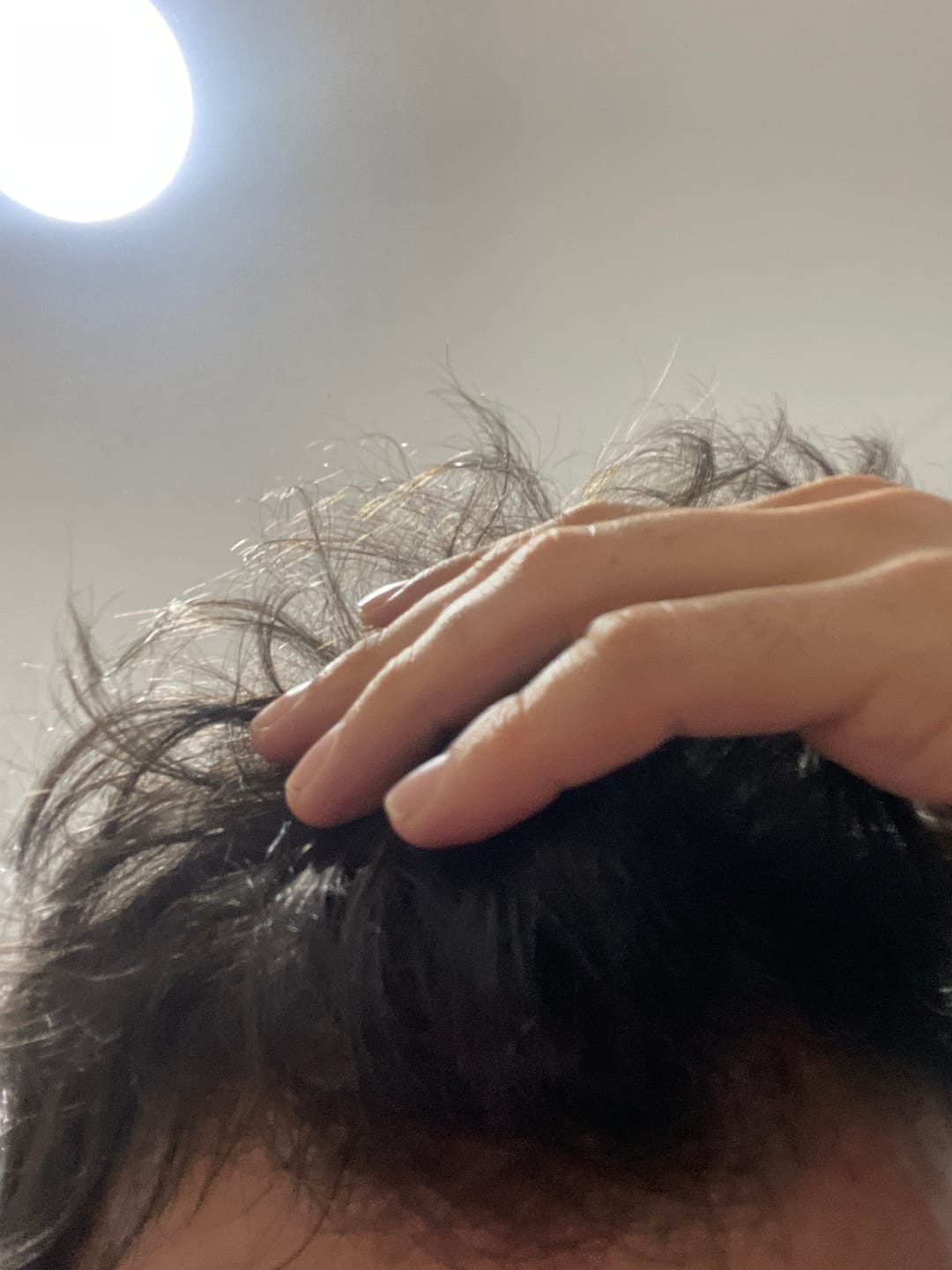 Customer photo review of Tratamiento anticaída 1 mes + Biotina