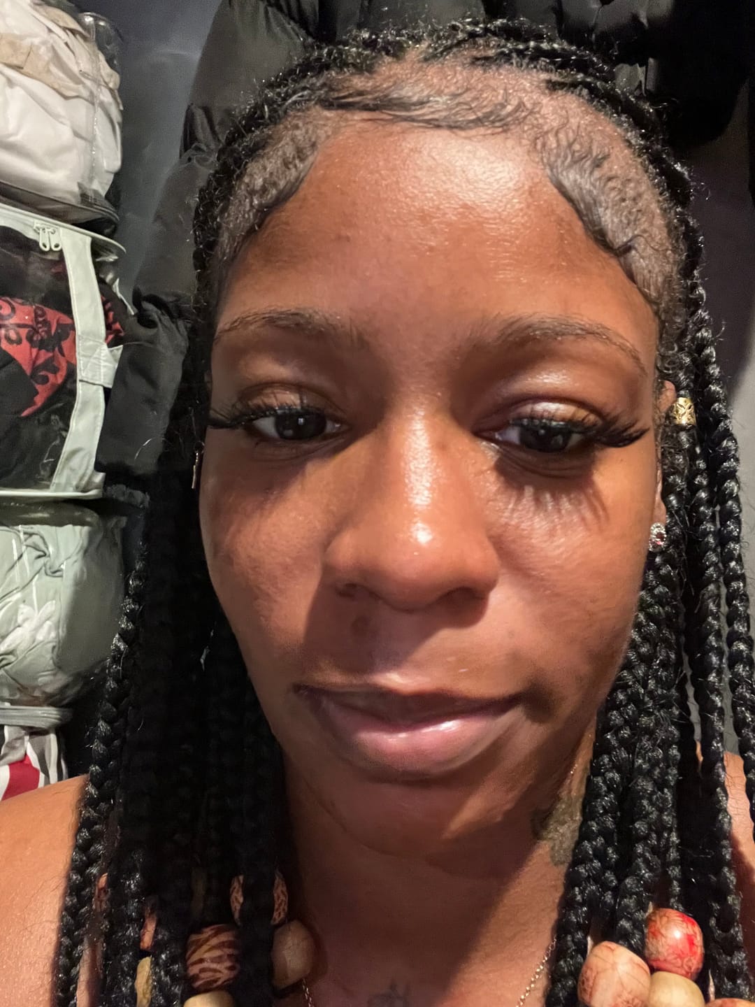 Customer photo review of Belle Nubian Dark Spot Remover Serum