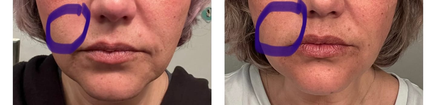 Customer photo review of GLOW RED LIGHT WAND