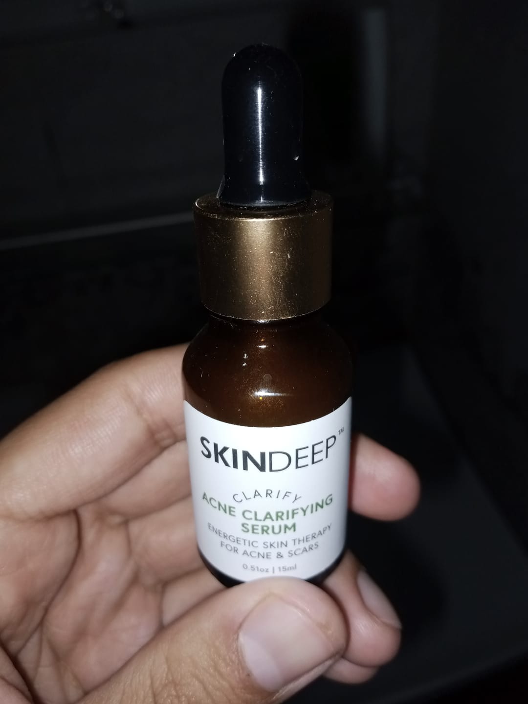 Customer photo review of ACNE CLARIFYING SERUM - Energetic Skin Therapy for Acne & Scars