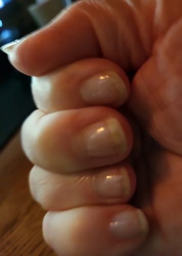 Customer photo review of Rocket Nail Fuel Nail Repair - Clear