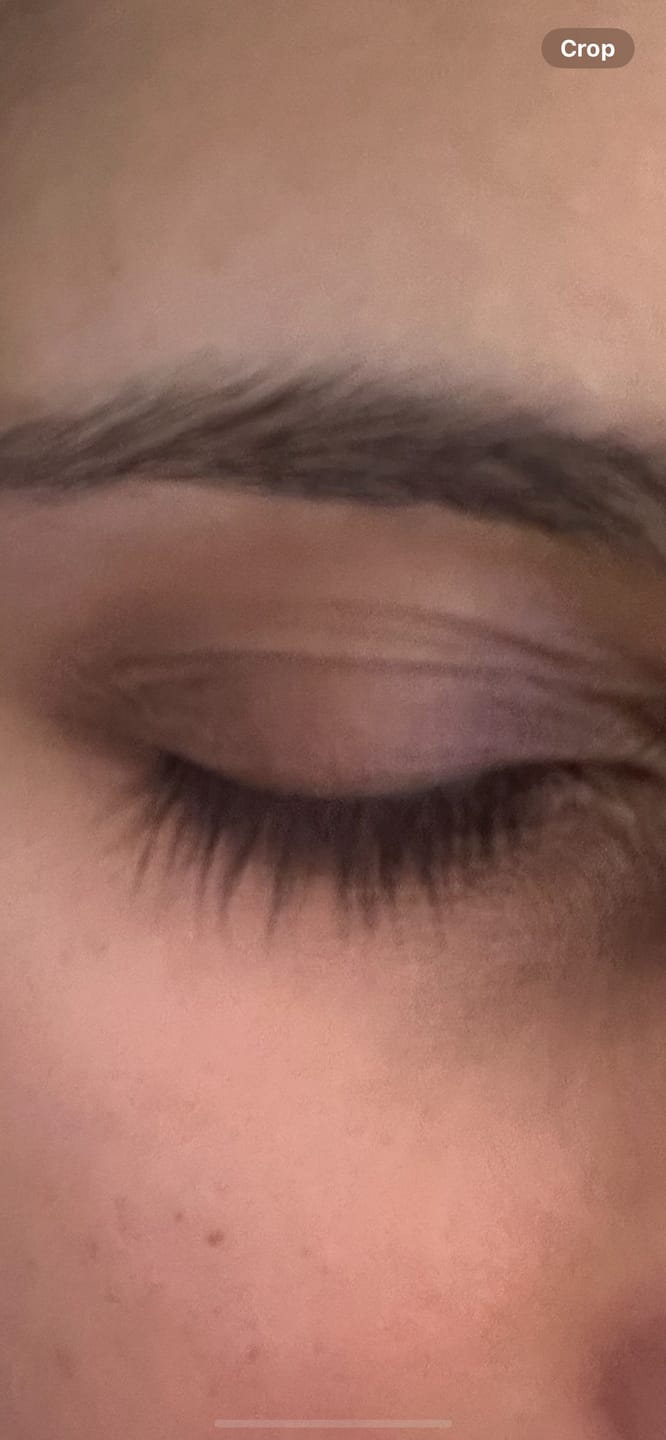 Customer photo review of Infinaluxe Gentle Lash Removal Serum (NEW)
