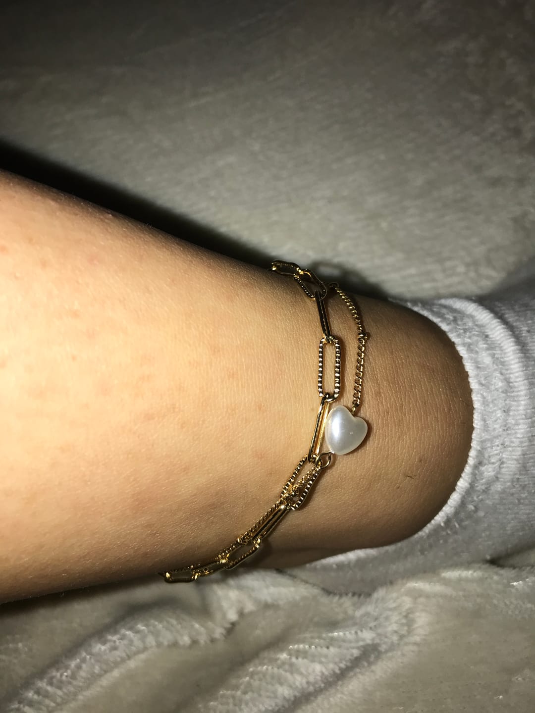 Customer photo review of Pearl Link Fußkette | 18K vergoldet