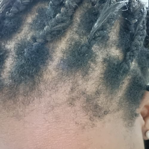 Customer photo review of Hairline Fortifying Serum 30ml