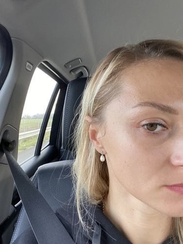 Customer photo review of Huile de Pépins de Figue de Barbarie - 30 ml