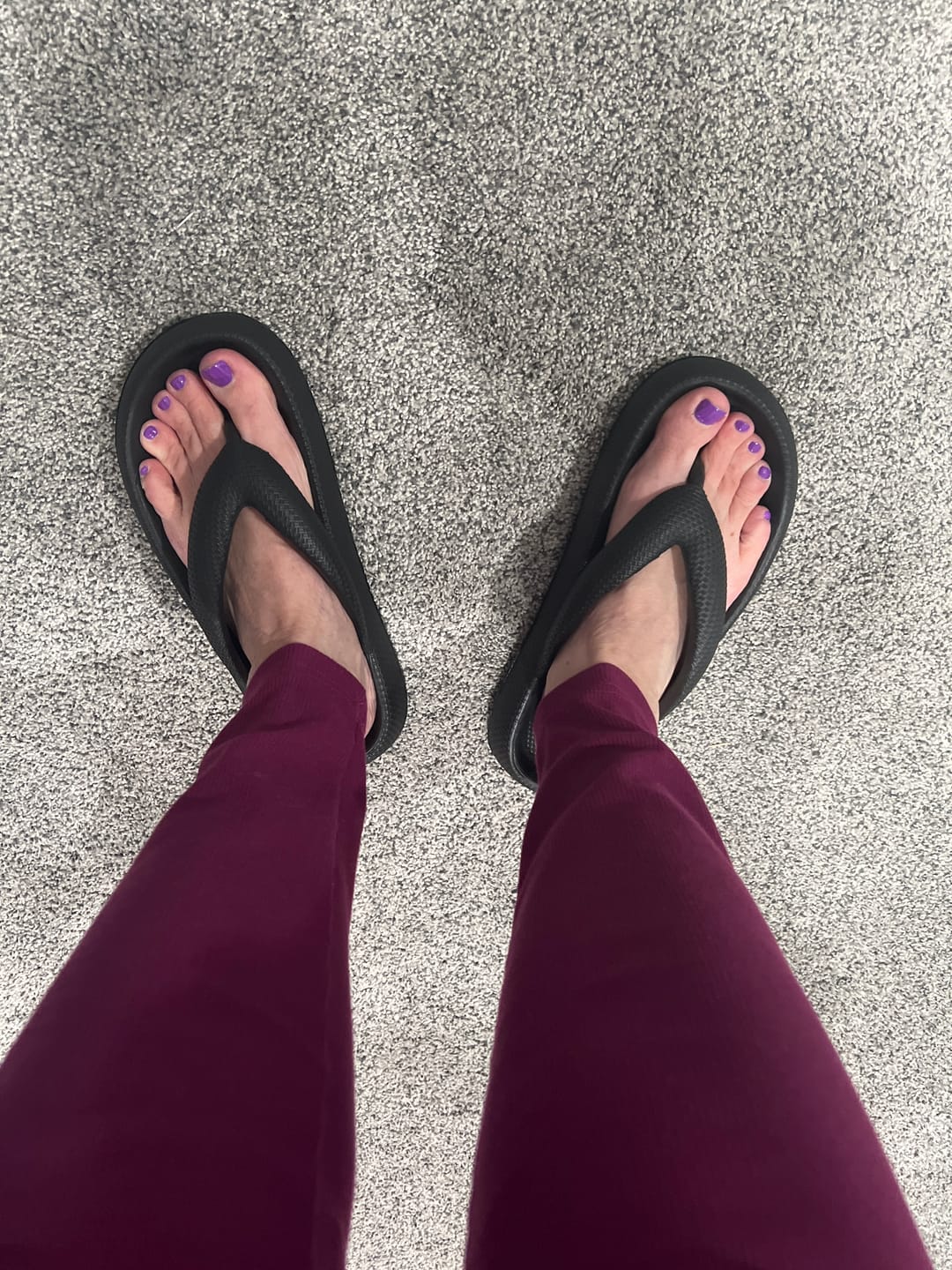 Customer photo review of Cushion Flip Flops - Cloud Slides