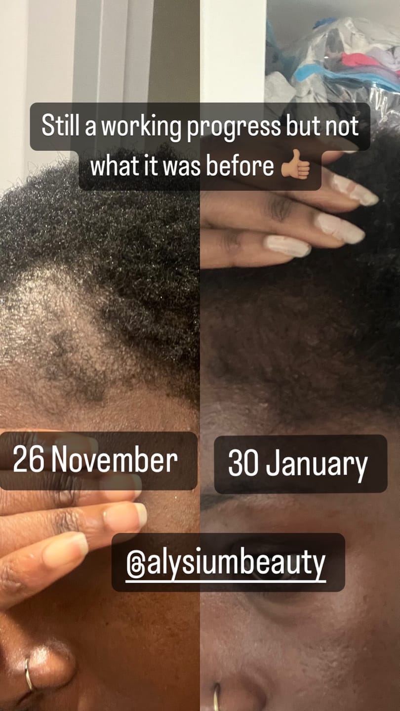 Customer photo review of Hair Growth / Thickening Oil