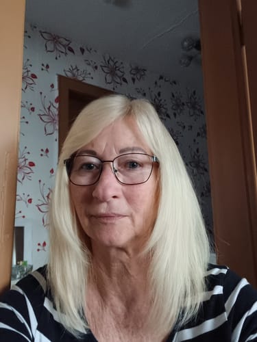 Customer photo review of Hyaluron Serum | Hyaluronic Serum