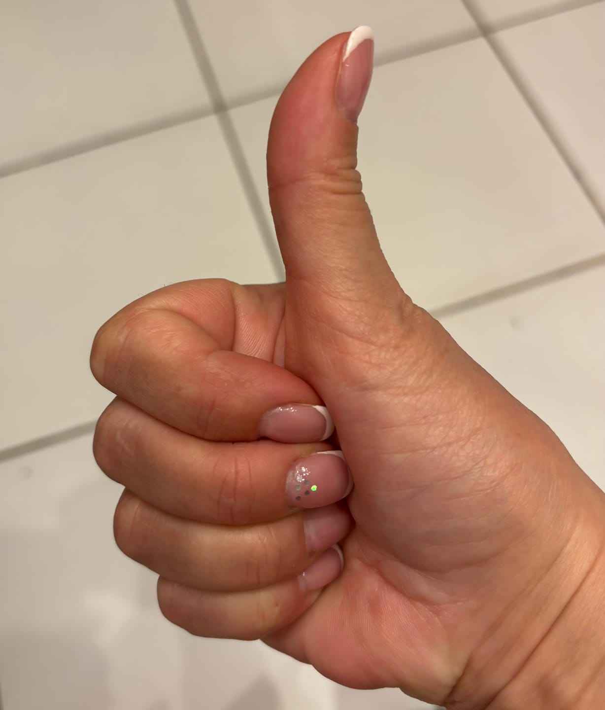 Customer photo review of Solo DIET konservi suņiem ar zirga gaļu.