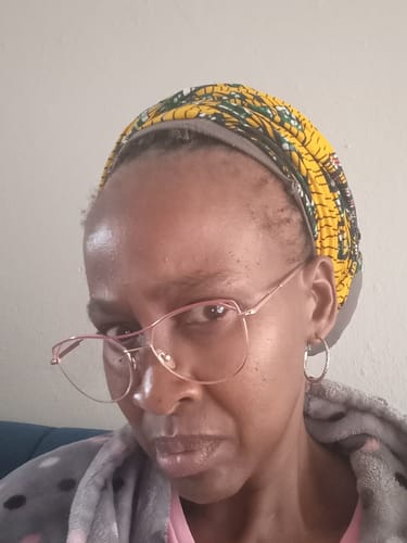 Customer photo review of Hairline Fortifying Serum 30ml