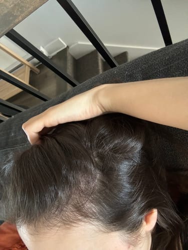 Customer photo review of Pre-Wash Scalp Oil by TR