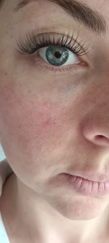 Customer photo review of QuickLash Starter Kit