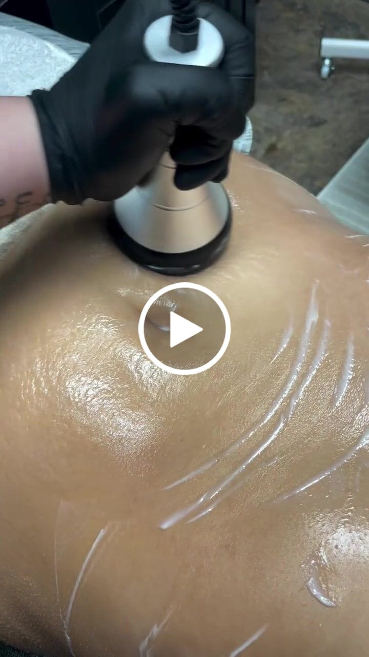 Customer video review of Adonis 6 in 1 Cavitation Machine for Fat Blasting