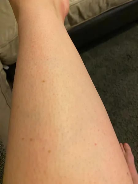 Customer photo review of SkinUp Clásica