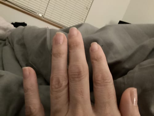 Customer photo review of The Nail System