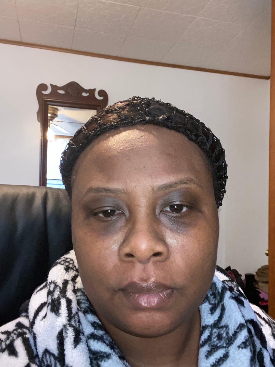 Customer photo review of A-Dream Brightening Eye Cream