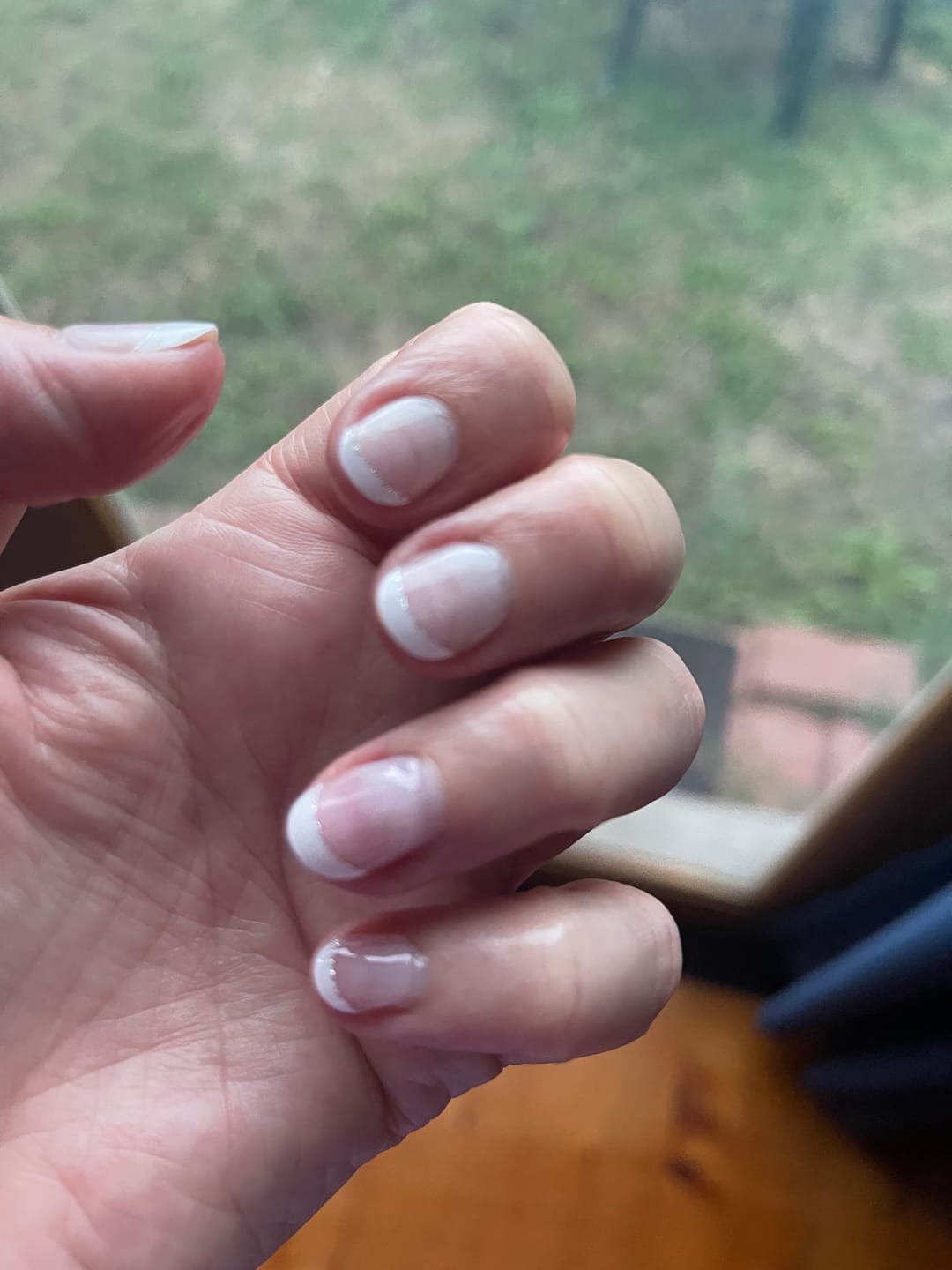 Customer photo review of Nourishing Cuticle Oil Pen & Gellae Nail Remover