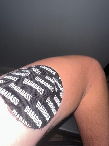 Customer photo review of Skin Grip Original - Freestyle Libre 2 Adhesive Patches - 20 Pack