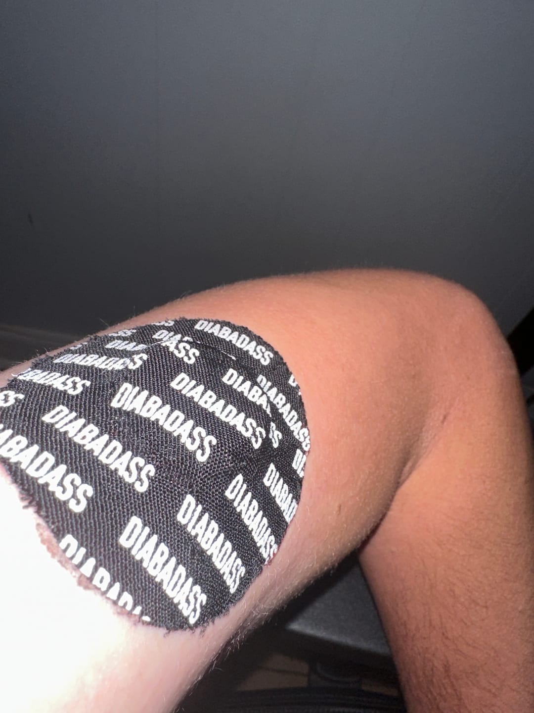 Customer photo review of Skin Grip Original - Freestyle Libre 2 Adhesive Patches - 20 Pack